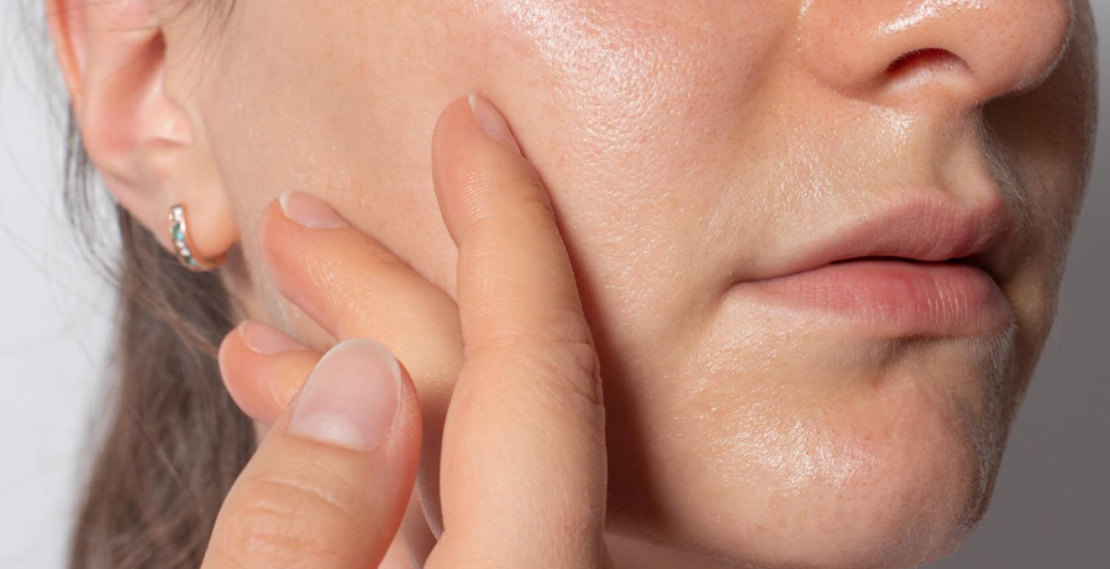 Розширені пори: проблема чи норма?