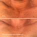HydroPeptide Firm-A-Fix Nectar 50ml Ліфтинг-сироватка для шиї та декольте