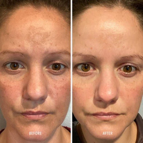 HydroPeptide Firma Bright 30ml Бустер з вітаміном С