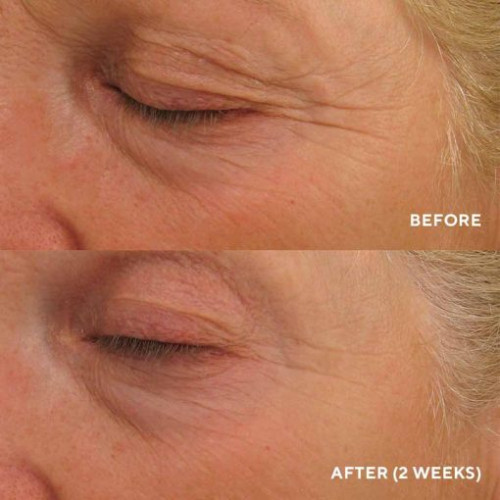 HydroPeptide Eye Authority 15ml Крем для комплексного омолодження зони навколо очей