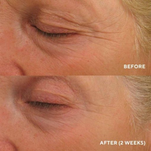 HydroPeptide Eye Authority 5ml МІНІАТЮРА Крем для комплексного омолодження зони навколо очей