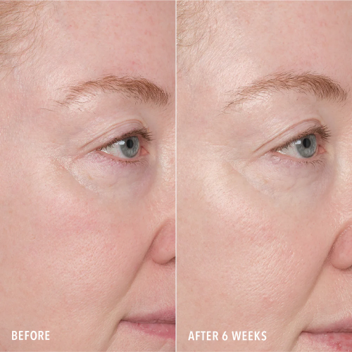 HydroPeptide Recurface and Repair Peptide Pads 1шт Пептидні пади для оновлення і регенерації шкіри