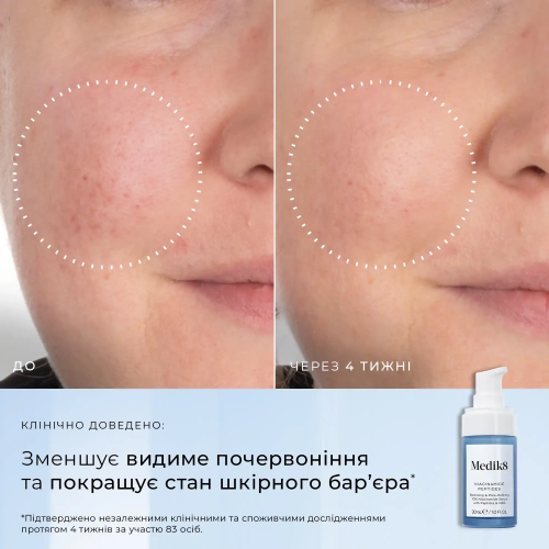 Medik8 Niacinamide Peptides 30ml Сироватка з ніацинамідом