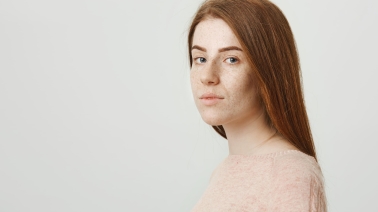 ретинол при куперозі