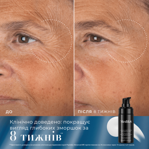 Medik8 Rejuvenation Reset Kit Відновлюючий і омолоджуючий набір — Фото 5