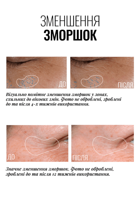 Instytutum Truly-Transforming Brightening Eye Cream 15ml Крем ліфтинг для повік з освітлювальним ефектом — Фото 2
