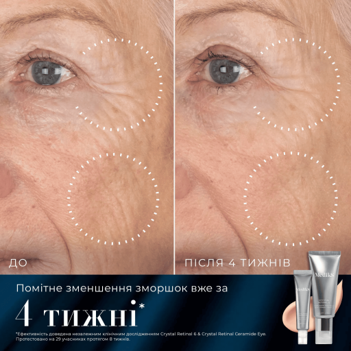 Medik8 Retinal Rewind Kit Лімітований набір з ретиналем — Фото 3