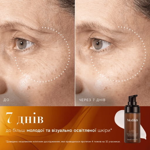 Medik8 C-Tetra Advanced Serum 30ml Гель-сироватка з 20% вітаміном С — Фото 3