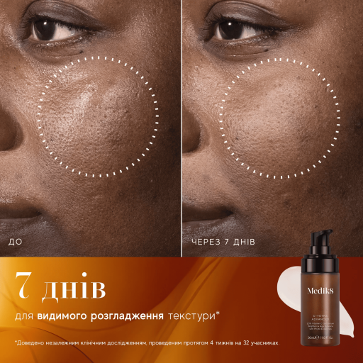 Medik8 C-Tetra Advanced Serum 30ml Гель-сироватка з 20% вітаміном С — Фото 4