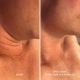 HydroPeptide Firm-A-Fix Nectar 50ml Ліфтинг-сироватка для шиї та декольте — Фото 6