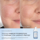 Medik8 Niacinamide Peptides 30ml Сироватка з ніацинамідом — Фото 10
